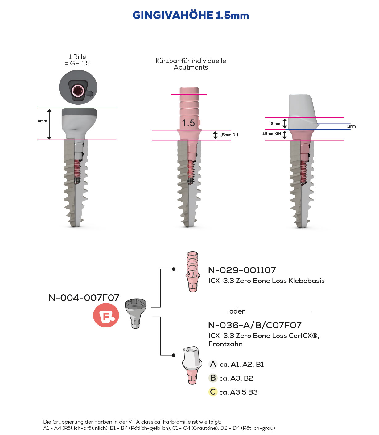 ICX-3.3 Zero Bone Loss, Scan & Heal, Anterior Teeth