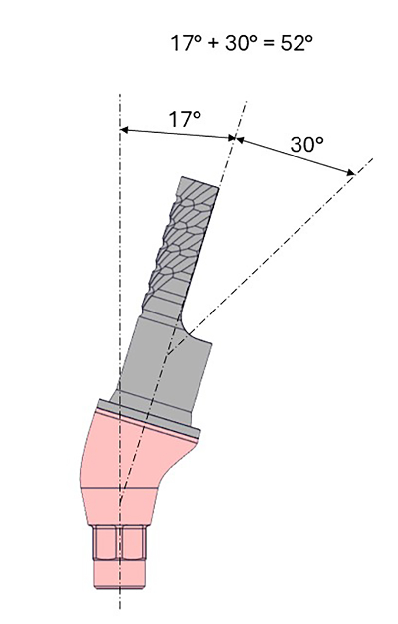 ICX-Ceramo Multi Aufbau, 17°, hex