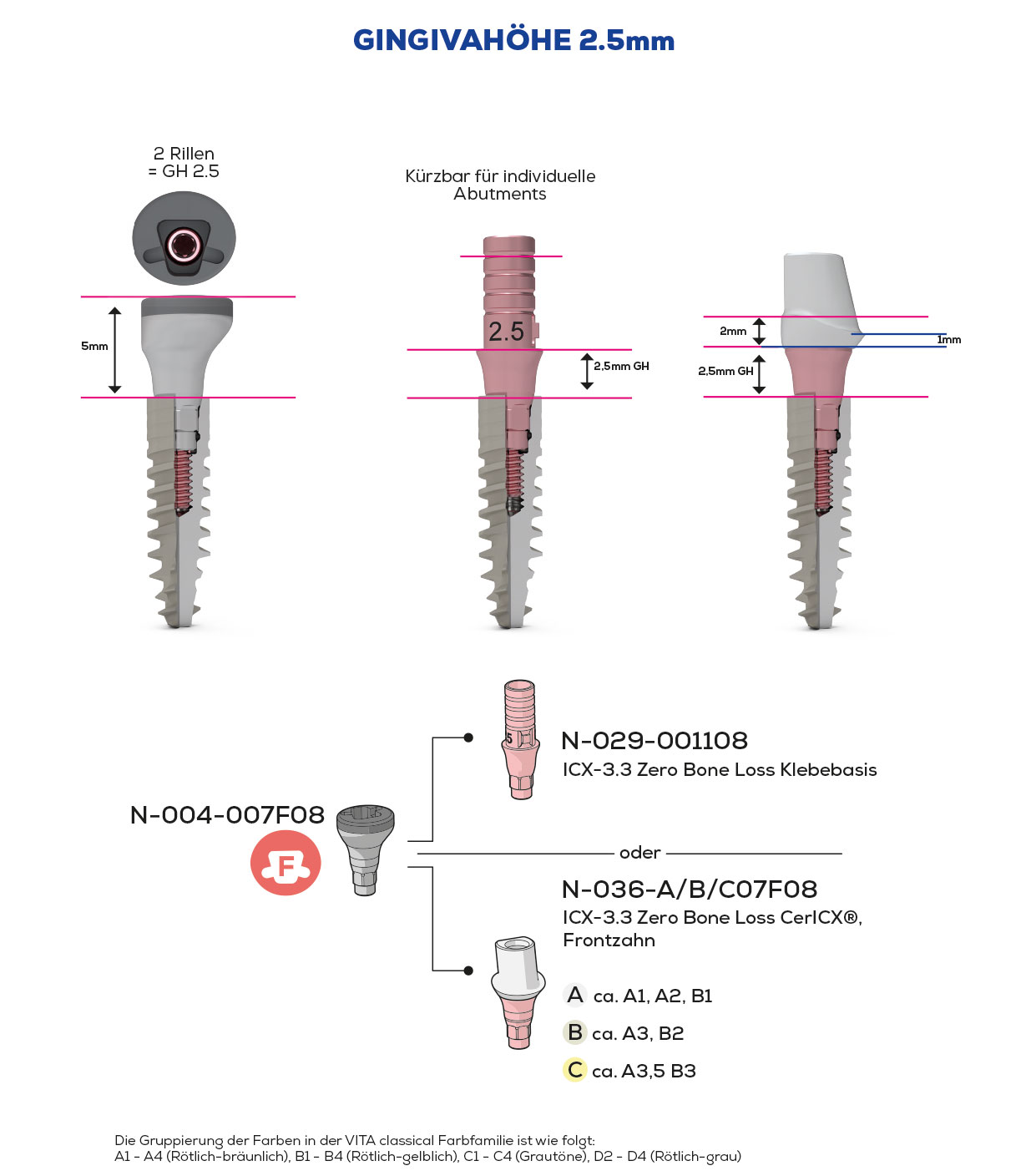 ICX-3.3 Zero Bone Loss, Scan & Heal, Anterior Teeth
