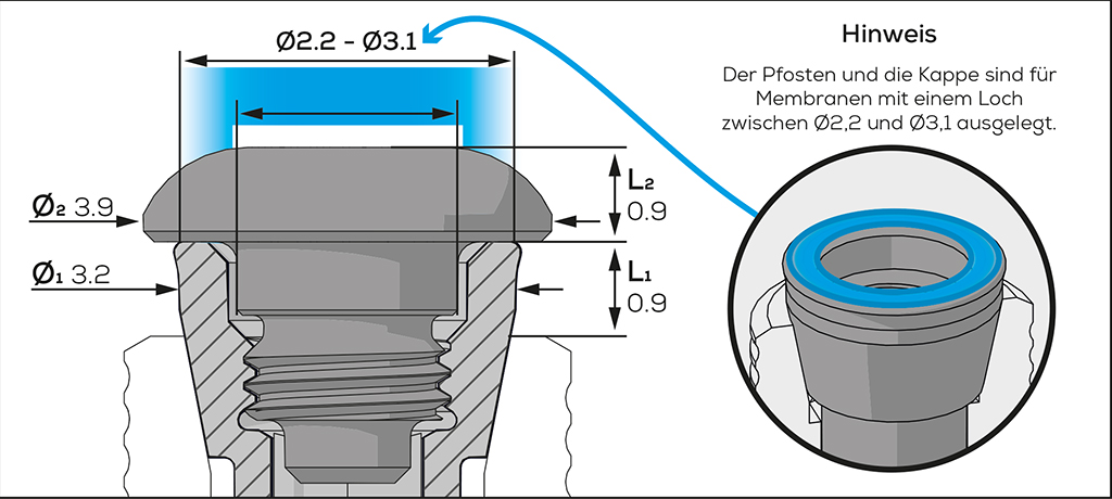 ICX Membrane Screw