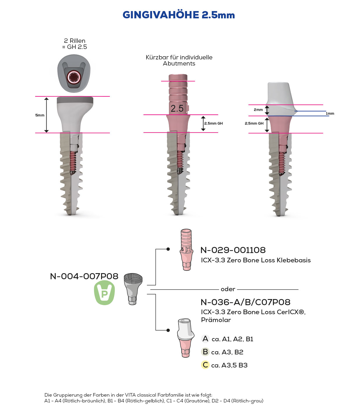 ICX-3.3 Zero Bone Loss, Scan & Heal, Premolar