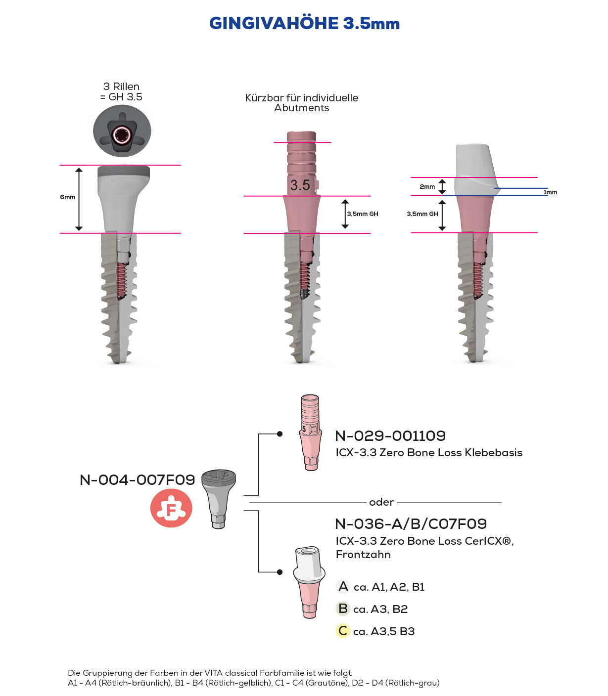 ICX-3.3 Zero Bone Loss, Scan & Heal, Anterior Teeth