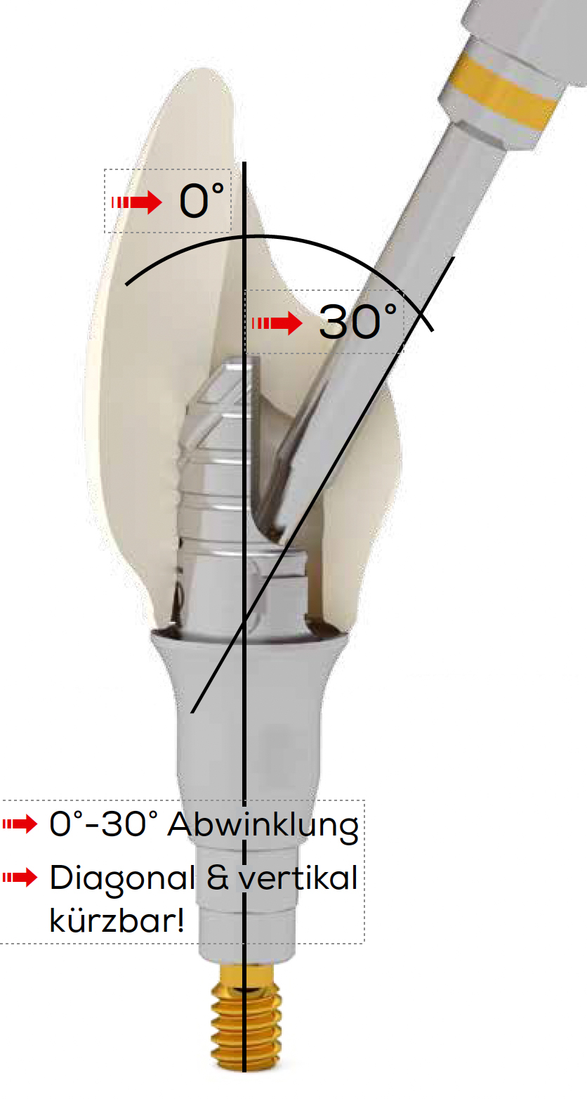 ICX-Flex-Klebebasis, Standard